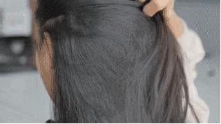 头皮屑多怎么根除最简单方法,如何彻底根治头皮屑的方法