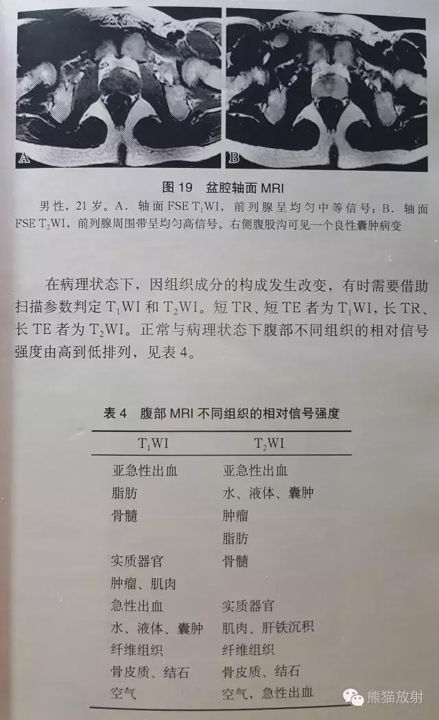 mri中t1wi和t2wi有什么区别,mri中t1w1与t2w1区别