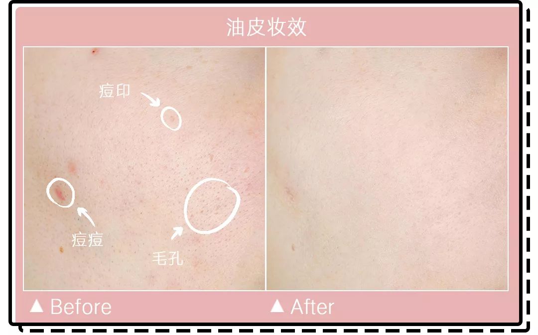 十大公认好用的混油皮粉底液排名,珀莱雅粉底液适合干皮还是油皮