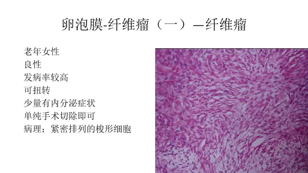 卵巢原发肿瘤的分析思路