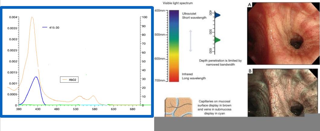支气管镜高频电刀治疗中央型肺癌,支气管镜在早期肺癌诊断的意义