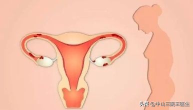 女性都该知道的9条妇科小常识！别被无良机构忽悠了