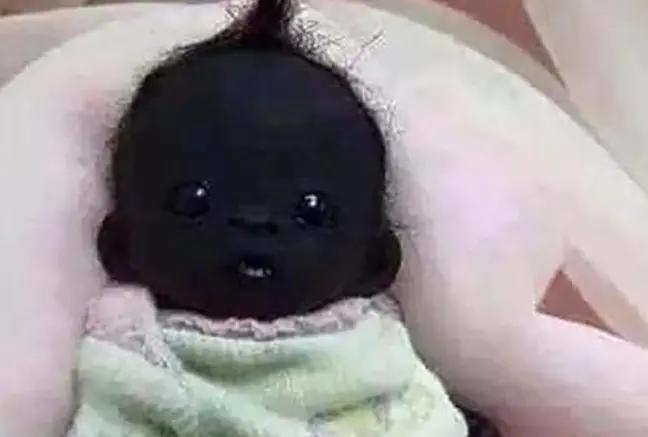 全世界最黑女婴,全世界最黑的婴儿