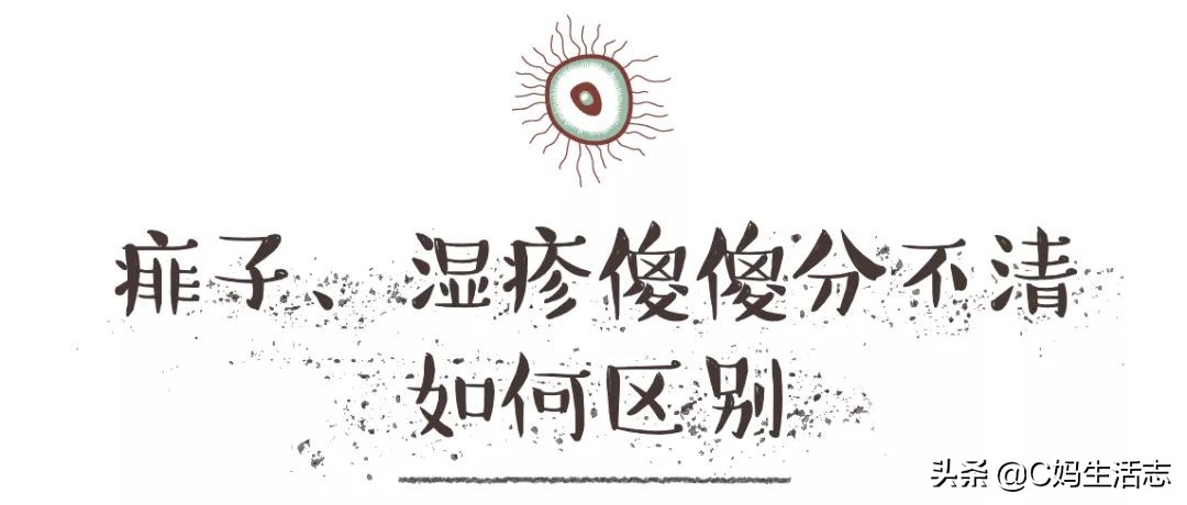 长痱子怎么办小妙招,夏天长痱子有什么食疗方法