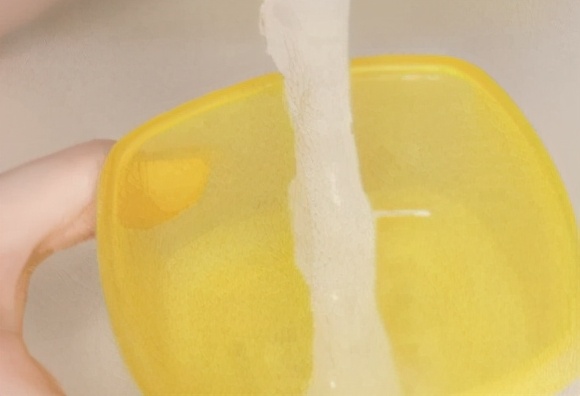 男性脱发怎么办最有效的方法,油脂性脱发治疗最有效的方法