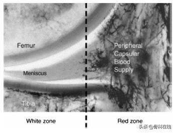 半月板修复视频教程,半月板术后修复