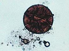 水产养殖藻类老化是怎样的,水产养殖显微镜下各种藻类