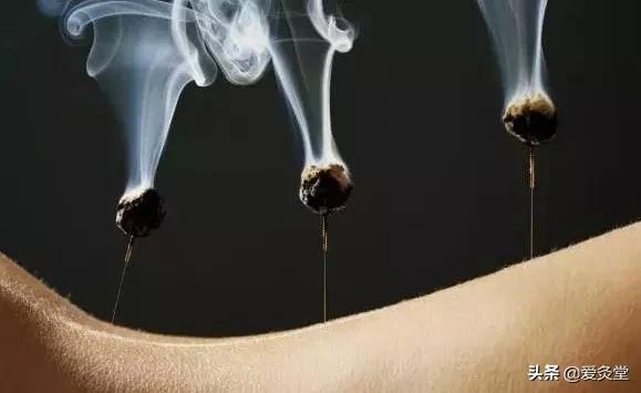 夏天艾灸该艾灸哪几个位置,又到了艾灸的季节