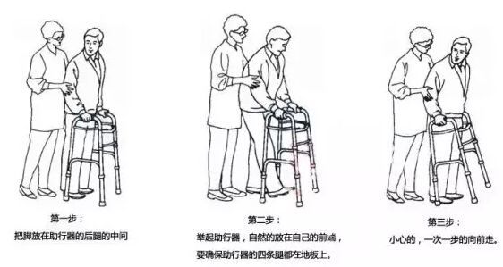 膝关节置换四十天应该怎样康复,膝关节置换术后两周内康复过程