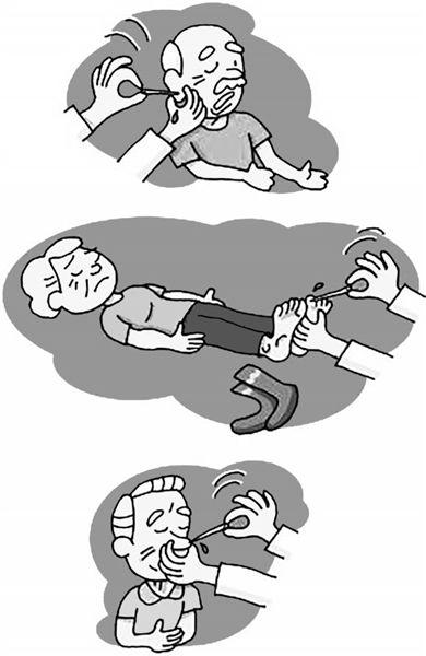 1岁男童脸烫伤,男童烫伤敷猫毛治疗