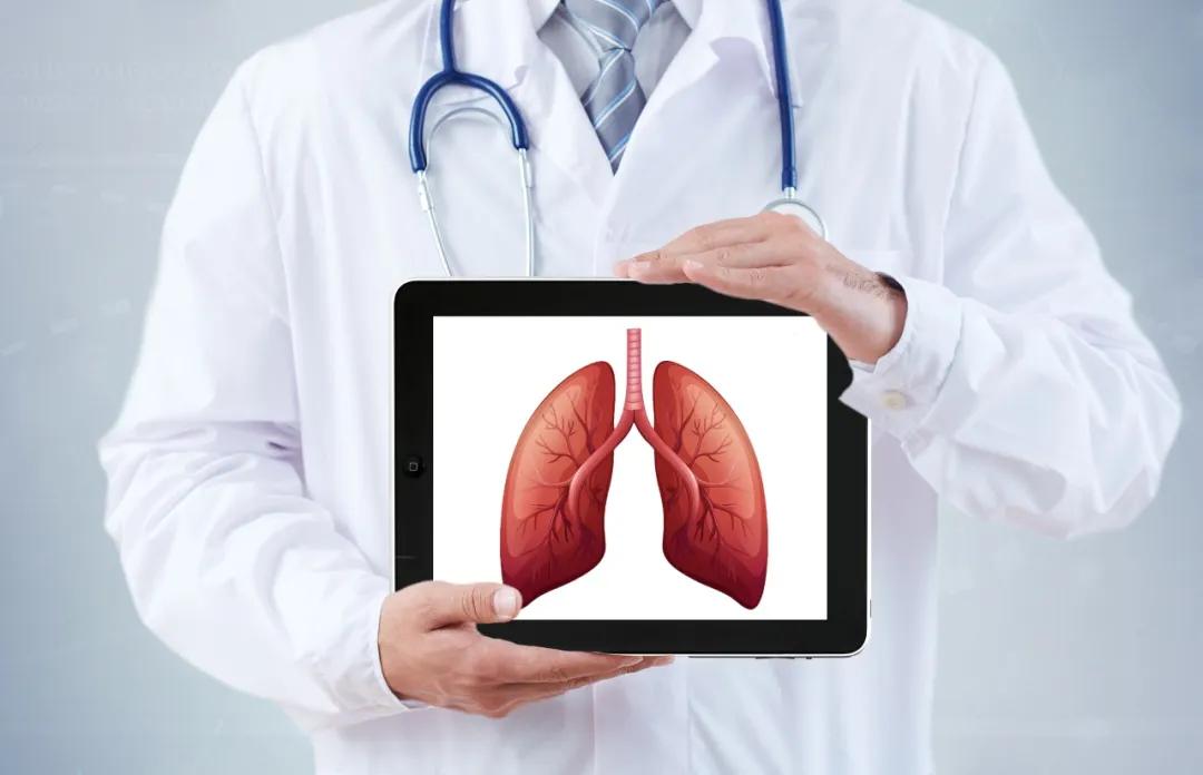 肺部结节警惕肺癌,肺部结节中危