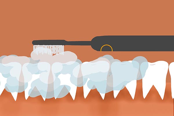 牙缝里面抠出来像石头一样的东西,牙缝中抠出的黄泥