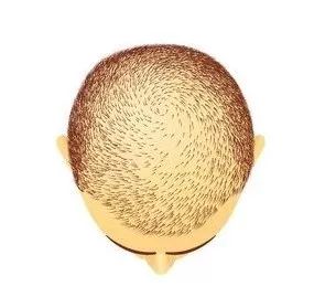 这么吃，最容易掉头发....