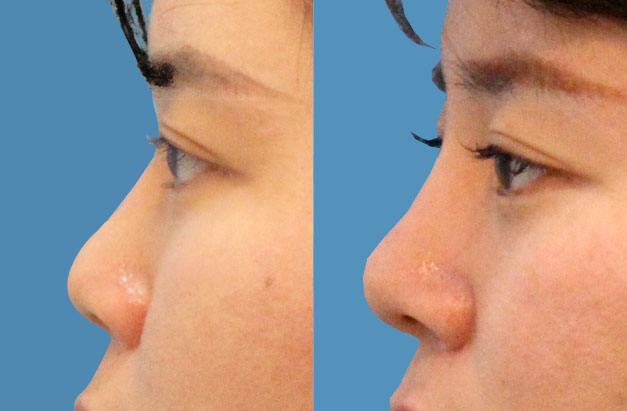 侧面好看和正面好看哪个好,女生侧面怎么才好看