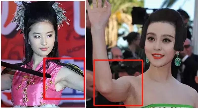 现在什么美容项目最赚钱最火,美容最挣钱的仪器