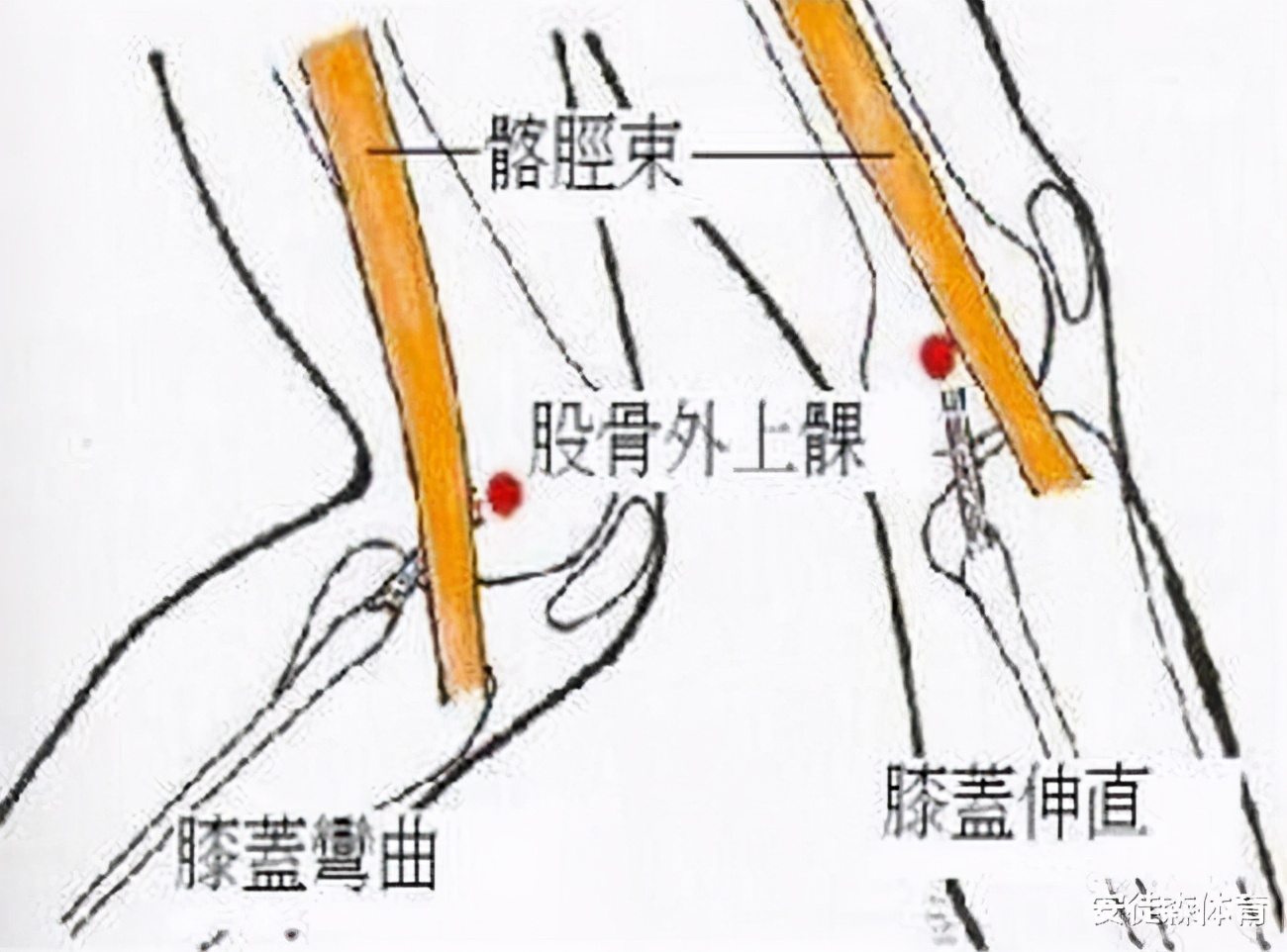 膝盖外侧痛怎么办,膝盖外侧痛贴什么膏药