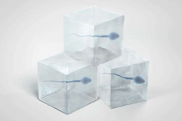 年龄大了精子数量会减少吗,精子数量怎么突然下降了