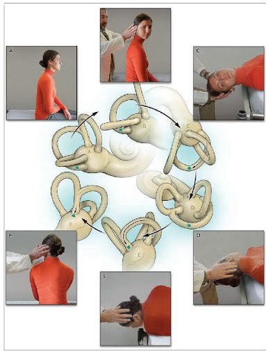 神经科眩晕常见病因,神经内科知识科普眩晕