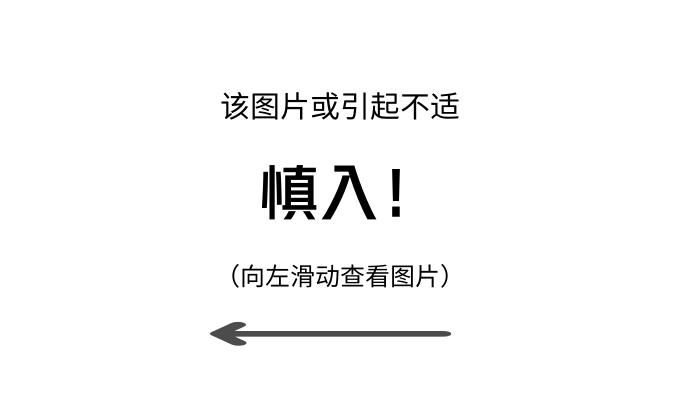 大叔被鱼刺扎伤,大叔被鱼刺伤