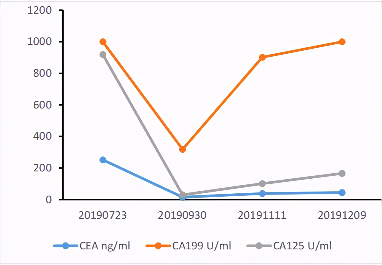 六旬男子小肠癌晚期，经化疗联合免疫治疗后疾病获得长期缓解。免疫治疗或将成为肠癌重要的治疗手段