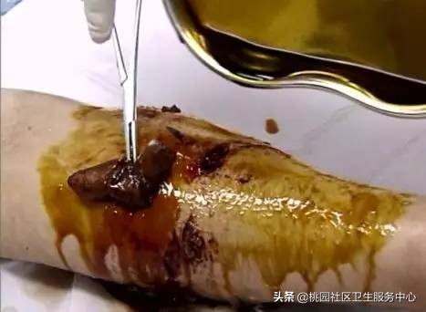 为啥鼠兔咬伤不用打狂犬疫苗,老鼠咬伤要不要打狂犬疫苗