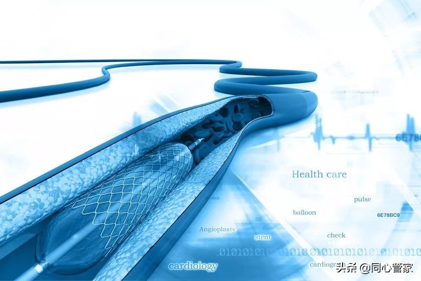 血管狭窄如何扼住生命的咽喉？让你全身器官都遭殃