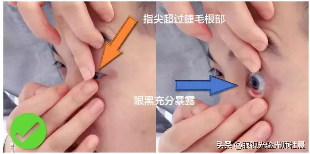 初次戴隐形眼镜感觉有点眩晕,初次戴隐形眼镜怎么取下来