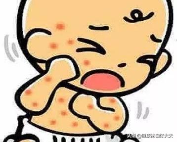 儿童湿疹引起白癜风能治好吗,湿疹后皮肤变白是白癜风吗