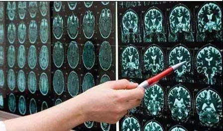 骨科医院拍片有哪几种,医院骨科拍片一般多少钱