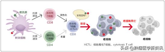 警惕！乳腺癌术后的淋巴水肿绝不能忽视