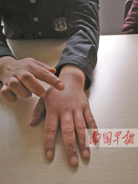 小区保安疑遭“黑旅馆”报复南宁东站附近一小区内藏身数十家“黑旅馆”；打人者因危重病情停止执行行拘