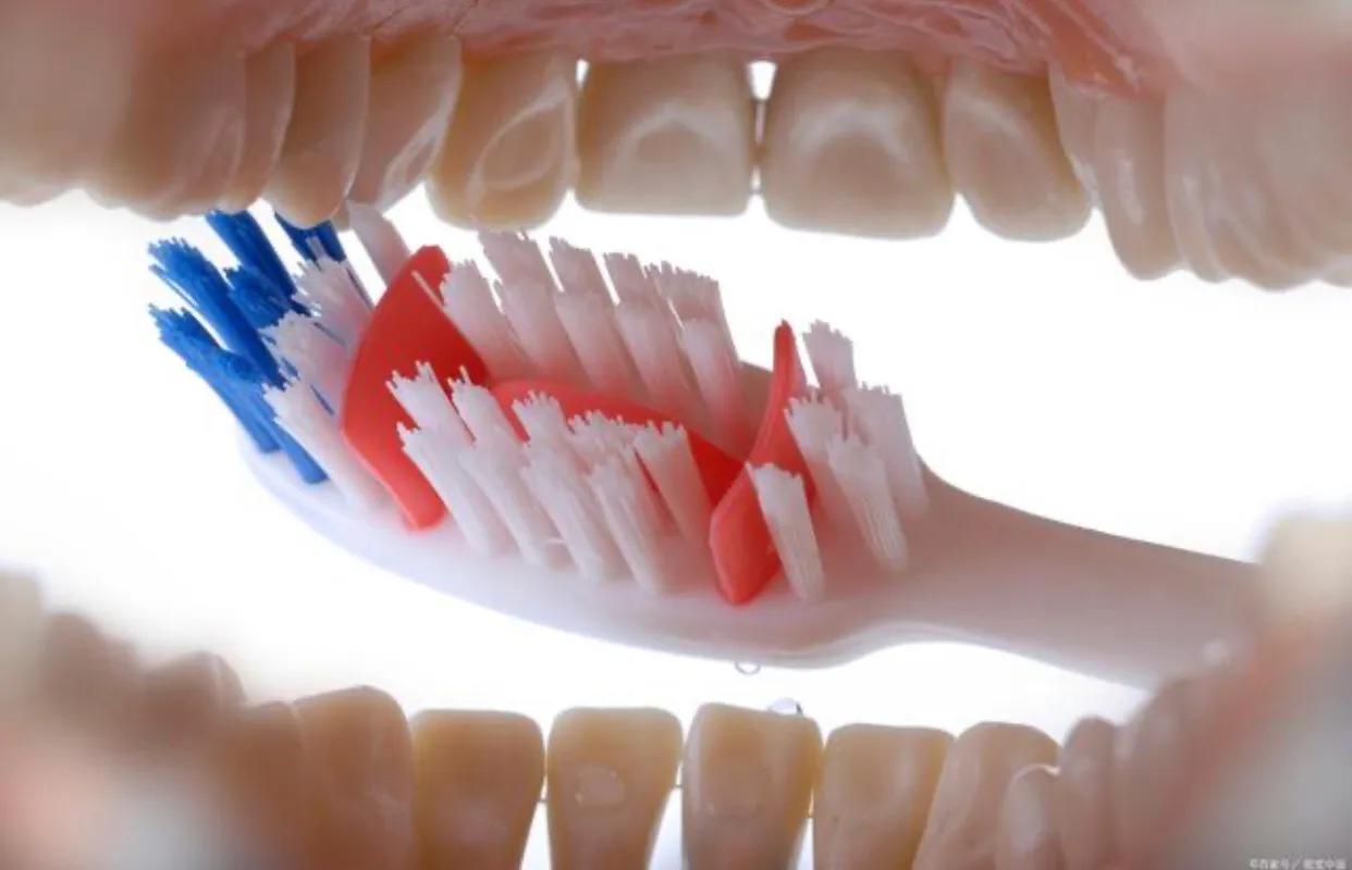 真正超声波牙刷洁牙器,超声波洁牙器是智商税吗