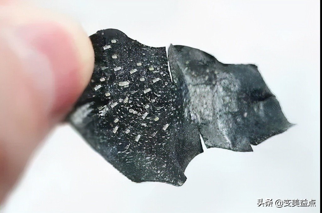 鼻头上很多油脂型黑头怎么办,鼻头黑头反复出现怎么解决