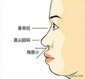 凸嘴有什么方法改善,形成嘴凸的原因