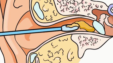 宝宝身上这四个部位不宜过度清洗,宝宝身上这四个部位越脏越好