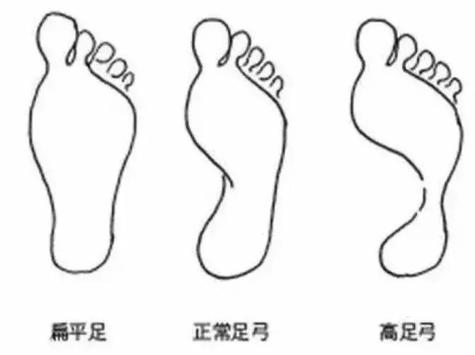 黄晓明回应“增高鞋垫”风波，高脚背的人，到底该如何选鞋？