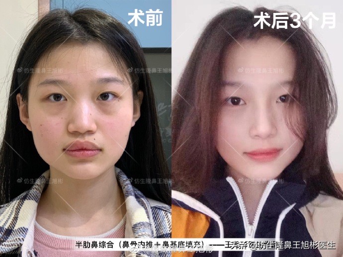 被鼻子封印的颜值,那些被鼻子封印的颜值