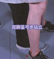 吃东西噎住了急救办法动画,吃东西噎住小技巧搞笑