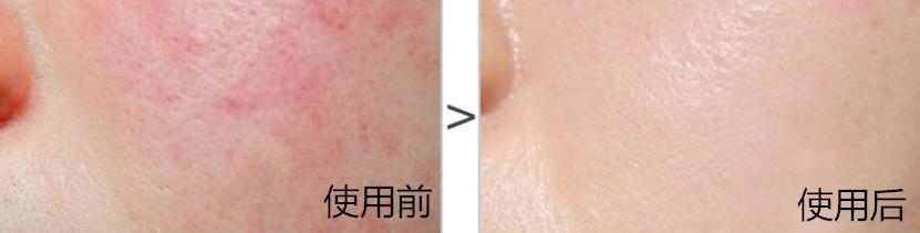 日本敏感皮肤面霜,日本人五合一面霜