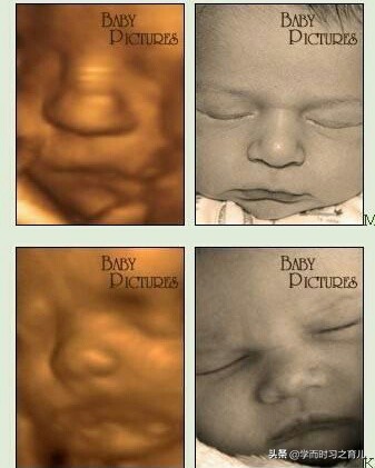 孕妇四维图片上为什么会有阴影,宝宝四维照为什么鼻子嘴巴都很大