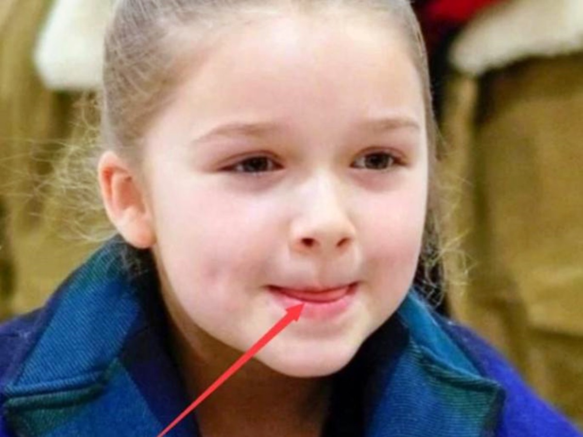 孩子嘴唇干裂起皮怎么快速解决,喝水多但嘴巴干裂起皮什么原因