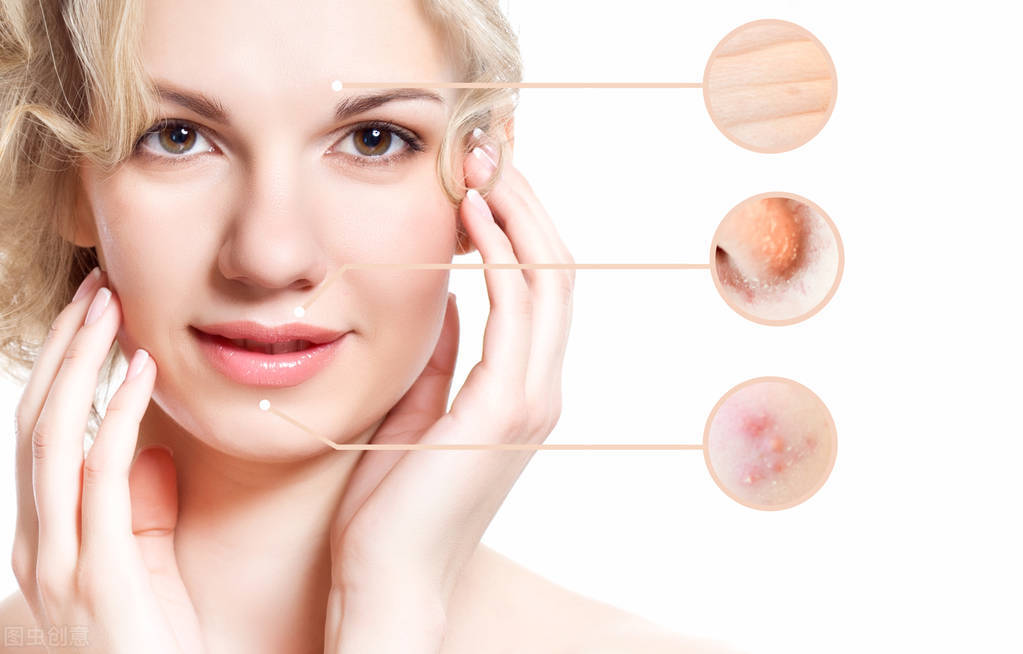 为什么会长痘怎样才能预防长痘,痘痘到底是怎么长出来的