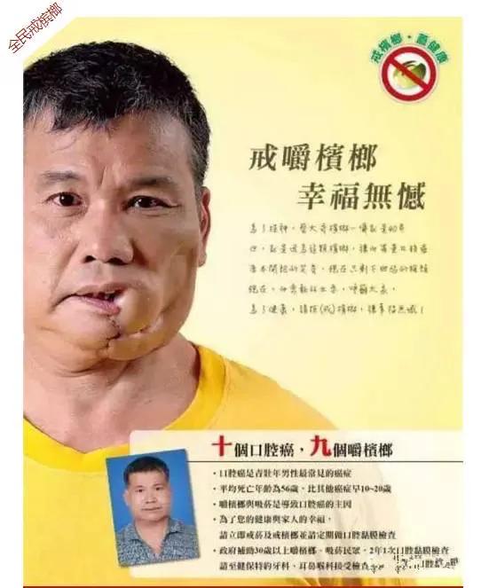 日本吃槟榔的危害,槟榔吃了6年