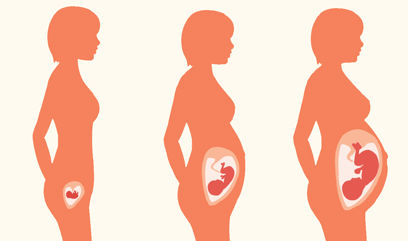 宝宝脐带绕颈孕妈有感觉吗,胎宝宝脐带绕着怎么办