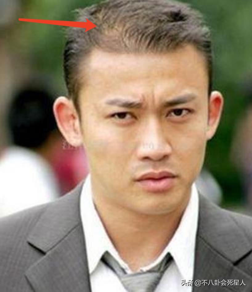 沙溢黄晓明脱发指数视频,黄晓明和沙溢最新视频