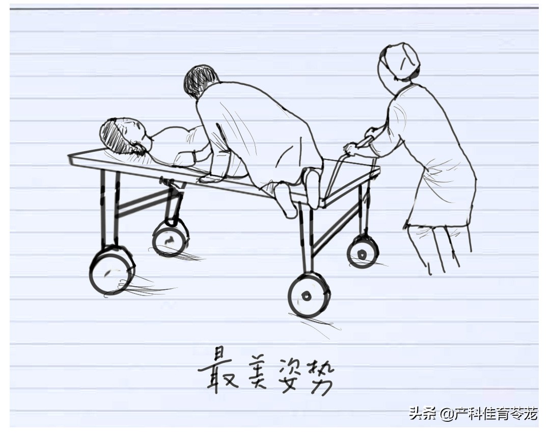 脐带脱垂,破水以后最害怕的事儿