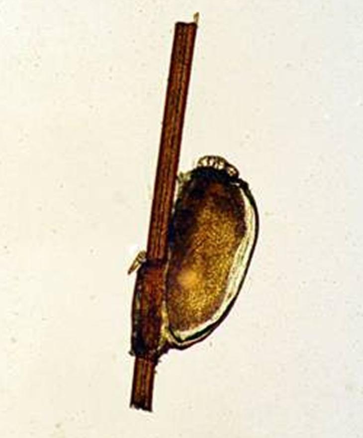 30年前人人身上都有的虱子,30年前人人都有虱子为啥现在消失