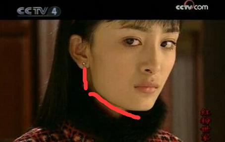 那些一刀切削骨的明星还好吗？后遗症一大堆，小方脸成最大赢家