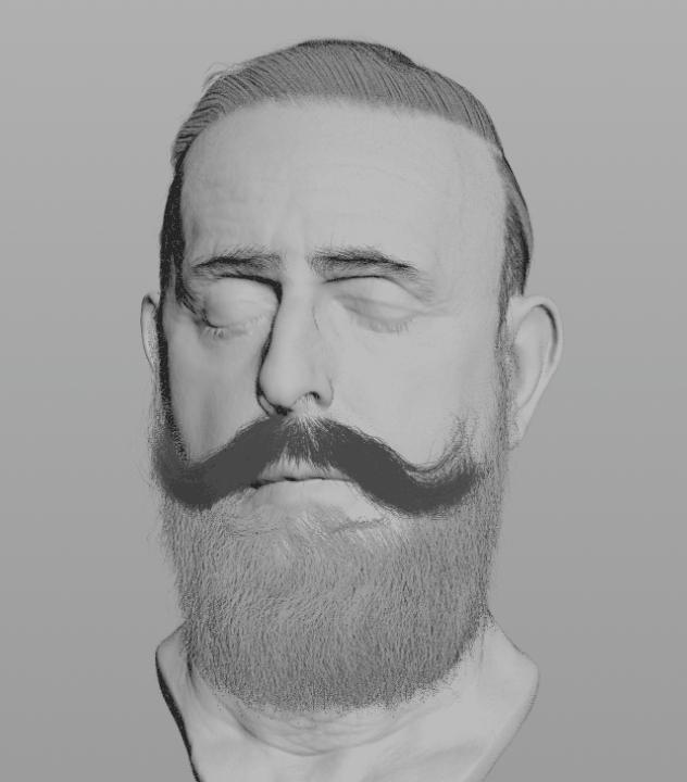 脱发过程3d动画,脱发有救了