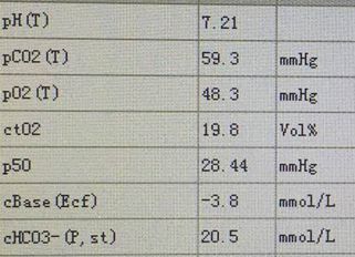 医学生教育系列知识一血气分析